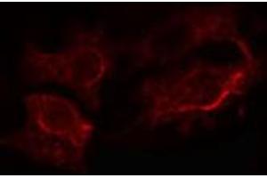 ABIN6272305 staining LOVO cells by IF/ICC. (GANAB anticorps  (Internal Region))