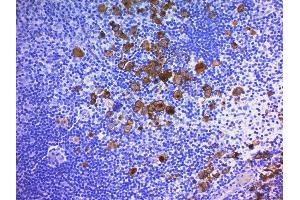 Formalin-fixed, paraffin-embedded human Hodgkin's Lymphoma stained with CD30 Monoclonal Antibody (Ber-H2 + CD30/412). (TNFRSF8 anticorps)