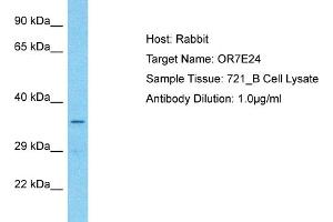 Host: Rabbit Target Name: OR7E24 Sample Type: 721_B Whole Cell lysates Antibody Dilution: 1.