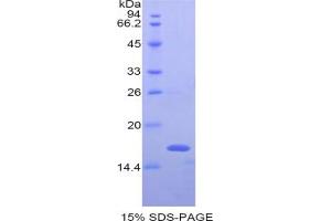 SDS-PAGE analysis of Mouse NAGase Protein. (MGEA5 Protéine)