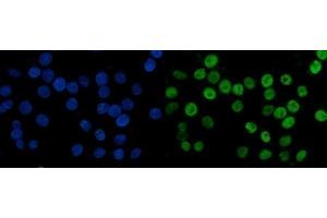 IF analysis of MCM6 using anti-MCM6 antibody (ABIN7600037). (MCM6 anticorps  (AA 14-821))