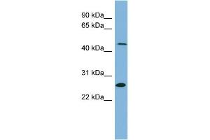 WB Suggested Anti-UPB1 Antibody Titration:  0.