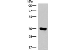 Western blot analysis of Human muscle tissue lysate using KCNK15 Polyclonal Antibody at dilution of 1:1000 (KCNK15 anticorps)