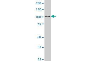 SALL4 monoclonal antibody (M03), clone 6E3 Western Blot analysis of SALL4 expression in Hela S3 NE .