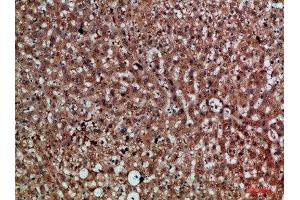 Immunohistochemical analysis of paraffin-embedded human-liver, antibody was diluted at 1:200