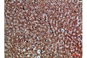Immunohistochemical analysis of paraffin-embedded human-liver, antibody was diluted at 1:200 (CDNF anticorps  (AA 31-80))