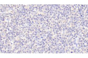 Detection of CNN2 in Human Lymph node Tissue using Polyclonal Antibody to Calponin 2 (CNN2)