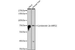 Western blot analysis of extracts of various cell lines, using Cytokeratin 2e (KRT2) antibody (ABIN6129540, ABIN6143025, ABIN6143026 and ABIN6214608) at 1:1000 dilution. (Keratin 2 anticorps  (AA 1-220))