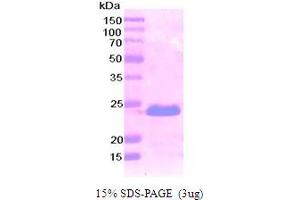 SDS-PAGE (SDS) image for Podoplanin (PDPN) (AA 99-207) protein (His tag) (ABIN667074)