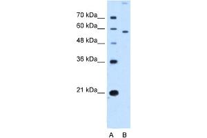 WB Suggested Anti-SLC22A2 Antibody Titration:  2. (SLC22A2 anticorps  (N-Term))