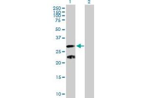 Western Blot analysis of C9orf152 expression in transfected 293T cell line by C9orf152 MaxPab polyclonal antibody. (C9orf152 anticorps  (AA 1-218))