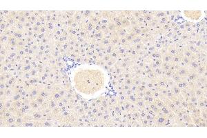 Detection of GLS2 in Mouse Liver Tissue using Polyclonal Antibody to Glutaminase 2 (GLS2)