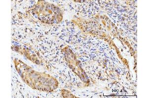IHC analysis of HMGCS1 using anti-HMGCS1 antibody (ABIN7600928).