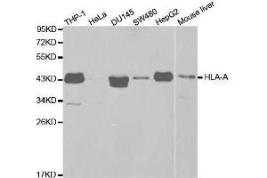 Western blot analysis of extracts of various cell lines, using HLA-A antibody. (HLA-A anticorps  (AA 35-285))