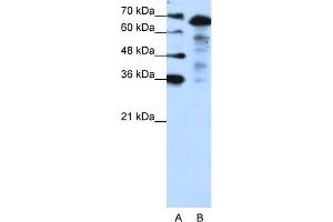WB Suggested Anti-MLXIPL Antibody Titration:  1. (MLXIPL anticorps  (N-Term))