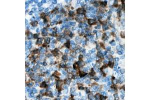 Immunohistochemical analysis of CDKL3 staining in human lymph node formalin fixed paraffin embedded tissue section. (CDKL3 anticorps  (Center))