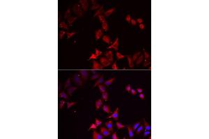 Immunofluorescence analysis of MCF7 cells using PCBD1 antibody. (PCBD1 anticorps  (AA 1-104))