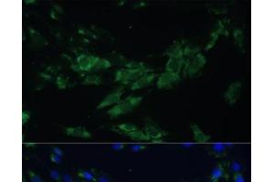 Immunofluorescence analysis of C6 cells using EPHA4 Polyclonal Antibody at dilution of 1:100. (EPH Receptor A4 anticorps)