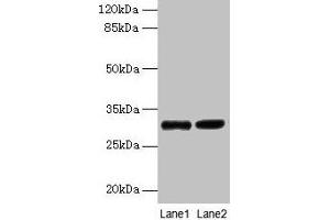 Western blot All lanes: UQCRQ antibody at 2 μg/mL Lane 1: EC109 whole cell lysate Lane 2: 293T whole cell lysate Secondary Goat polyclonal to rabbit IgG at 1/15000 dilution Predicted band size: 10 kDa Observed band size: 30 kDa