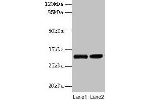 Western blot All lanes: UQCRQ antibody at 2 μg/mL Lane 1: EC109 whole cell lysate Lane 2: 293T whole cell lysate Secondary Goat polyclonal to rabbit IgG at 1/15000 dilution Predicted band size: 10 kDa Observed band size: 30 kDa (UQCRQ anticorps  (AA 2-78))