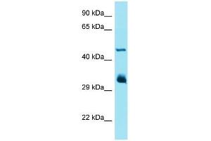 Western Blotting (WB) image for anti-Interferon-Induced Protein with Tetratricopeptide Repeats 1 (IFIT1) (Middle Region) antibody (ABIN2490346) (IFIT1 anticorps  (Middle Region))