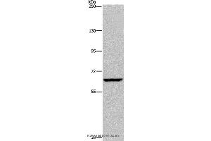 Western blot analysis of Hela cell, using IVL Polyclonal Antibody at dilution of 1:200 (Involucrin anticorps)