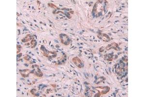 Used in DAB staining on fromalin fixed paraffin- embedded Kidney tissue