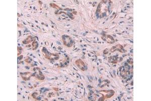 Used in DAB staining on fromalin fixed paraffin- embedded Kidney tissue (MYL6 anticorps  (AA 4-146))
