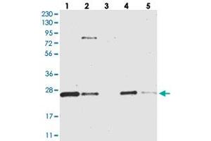 Western blot analysis of Lane 1: RT-4, Lane 2: U-251 MG, Lane 3: Human Plasma, Lane 4: Liver, Lane 5: Tonsil with CCDC90B polyclonal antibody  at 1:250-1:500 dilution. (CCDC90B anticorps)
