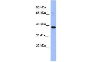 WB Suggested Anti-IER5 Antibody Titration: 0. (IER5 anticorps  (N-Term))