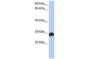 RAB39B antibody used at 1 ug/ml to detect target protein. (RAB39B anticorps  (N-Term))