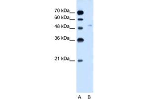Western Blotting (WB) image for anti-Solute Carrier Family 2 (Facilitated Glucose Transporter), Member 6 (SLC2A6) antibody (ABIN2462758) (SLC2A6 anticorps)