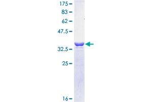 Image no. 1 for Proteasome (Prosome, Macropain) 26S Subunit, Non-ATPase, 14 (PSMD14) (AA 1-95) protein (GST tag) (ABIN1316631)