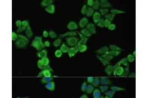 Immunofluorescence analysis of HeLa cells using Fibronectin Polyclonal Antibody at dilution of 1:100. (Fibronectin anticorps)