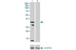 Western blot analysis of KCNJ15 over-expressed 293 cell line, cotransfected with KCNJ15 Validated Chimera RNAi (Lane 2) or non-transfected control (Lane 1).