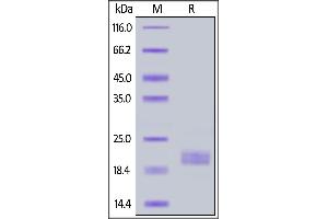 Biotinylated Human IL-2, His,Avitag on  under reducing (R) condition. (IL-2 Protein (AA 21-153) (His tag,AVI tag,Biotin))