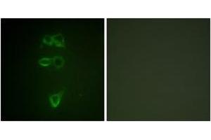 Immunofluorescence analysis of HepG2 cells, using TIE2 (Phospho-Tyr1108) Antibody. (TEK anticorps  (pTyr1108))