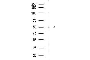 Western blot analysis of lysates from COLO205 cells(UV,30 min treatment), using W Antibody at 1/1000 dilution.