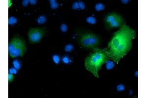 Anti-MAPK7 mouse monoclonal antibody (ABIN2454050) immunofluorescent staining of COS7 cells transiently transfected by pCMV6-ENTRY MAPK7 (RC203506). (MAPK7 anticorps)