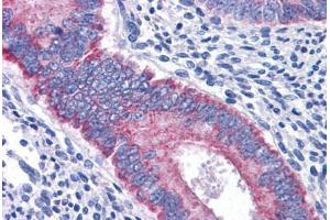 Human Uterus: Formalin-Fixed, Paraffin-Embedded (FFPE)