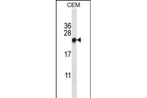 CBX5 Antibody (Center) (ABIN657701 and ABIN2846692) western blot analysis in CEM cell line lysates (35 μg/lane).