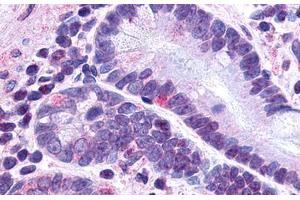 anti-Glucagon-Like Peptide 2 Receptor (GLP2R) (N-Term) antibody