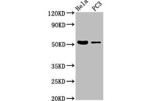 Western Blot Positive WB detected in: Hela whole cell lysate, PC-3 whole cell lysate All lanes: CELF6 antibody at 3.