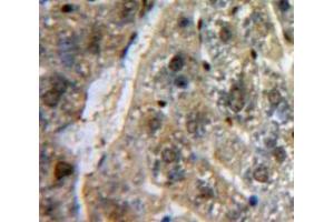 Used in DAB staining on fromalin fixed paraffin-embedded Liver tissue (SP100 anticorps  (AA 261-465))