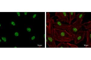 ICC/IF Image ADAR1 antibody [N3C1], Internal detects ADAR1 protein at nucleolus and nucleus by immunofluorescent analysis. (ADAR anticorps)