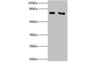 Western blot All lanes: POR antibody at 2 μg/mL Lane 1: K562 whole cell lysate Lane 2: A431 whole cell lysate Secondary Goat polyclonal to rabbit IgG at 1/10000 dilution Predicted band size: 77 kDa Observed band size: 77 kDa (POR anticorps  (AA 2-671))