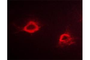 ABIN6267298 staining Hela cells by ICC/IF. (APP anticorps  (pThr668))