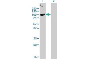 Western Blot analysis of SLC26A2 expression in transfected 293T cell line by SLC26A2 monoclonal antibody (M04), clone 3F6. (SLC26A2 anticorps  (AA 1-108))