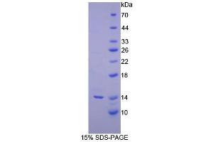 SDS-PAGE analysis of Human Inhibin beta C Protein. (INHBC Protéine)