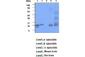 Western Blotting (WB) image for anti-Synuclein, alpha (SNCA) (AA 119-140) antibody (ABIN317563) (SNCA anticorps  (AA 119-140))